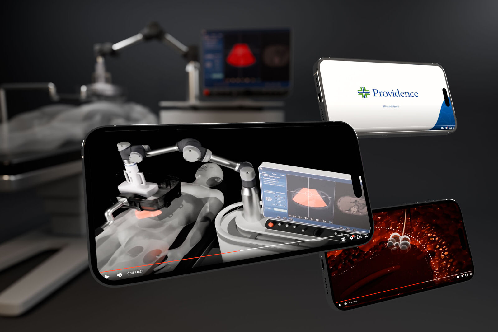 3D medical animation frame from the Providence histotripsy launch film