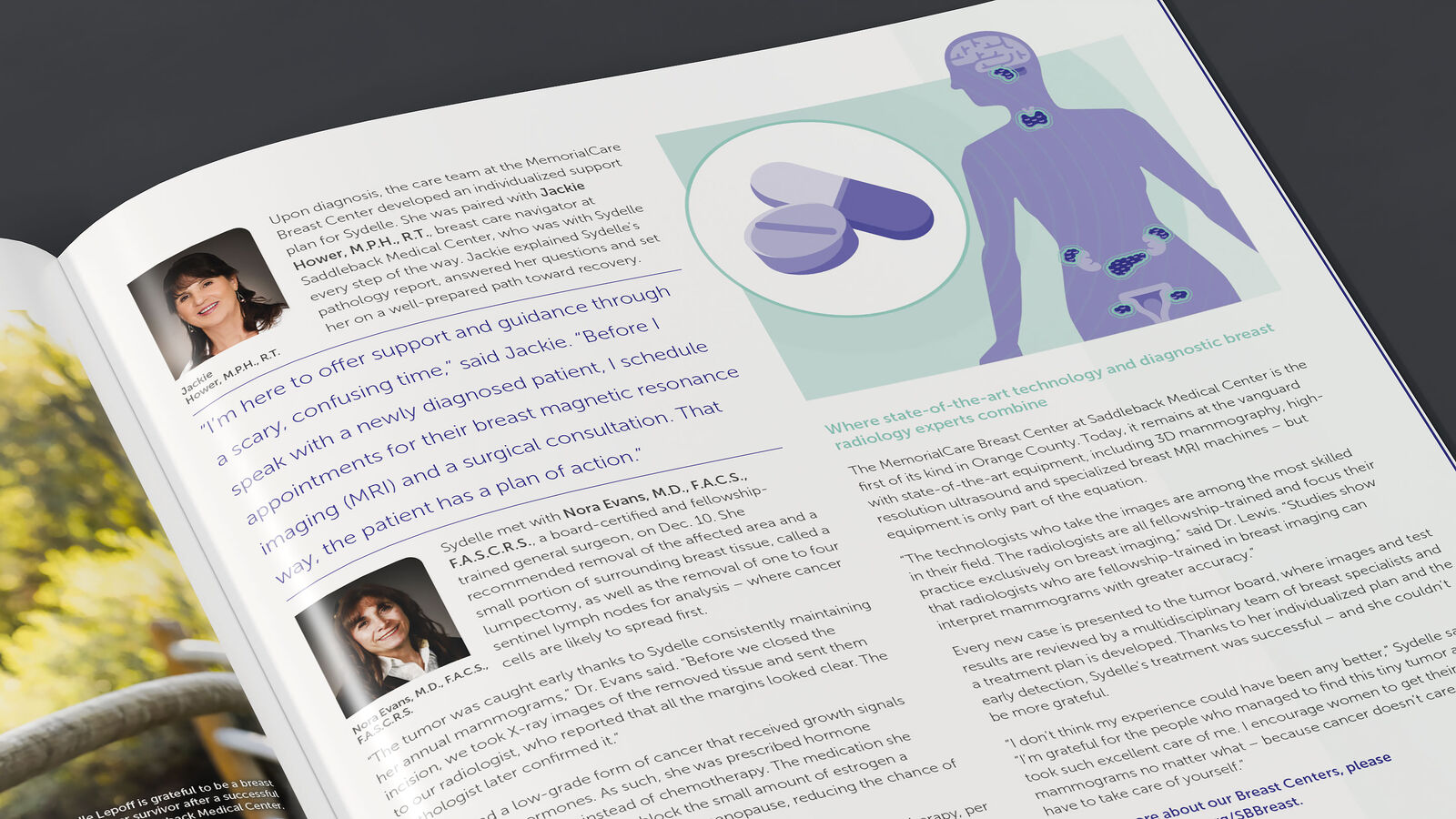 MemorialCare CareConnection breast health editorial spread